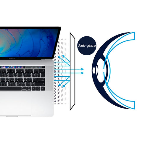 Anti-Glare & Anti-Blue light Screen Protector - Macbook Pro 15" ( 2016 2017 2018 2019 )